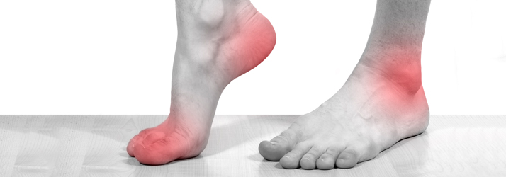 Neuropathy Treatment in Canonsburg and McMurray